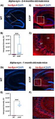 Evidence for prodromal changes in neuronal excitability and neuroinflammation in the hippocampus in young alpha-synuclein (A30P) transgenic mice